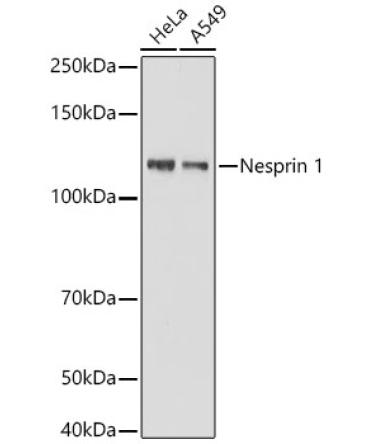 Nesprin 1 Rabbit Monoclonal Antibody