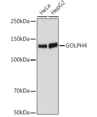 GOLPH4 Rabbit Monoclonal Antibody