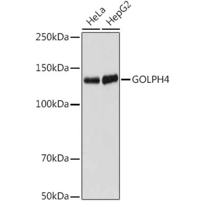 GOLPH4 Rabbit Monoclonal Antibody