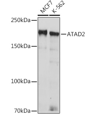 ATAD2 Rabbit Monoclonal Antibody