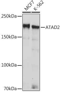 ATAD2 Rabbit Monoclonal Antibody