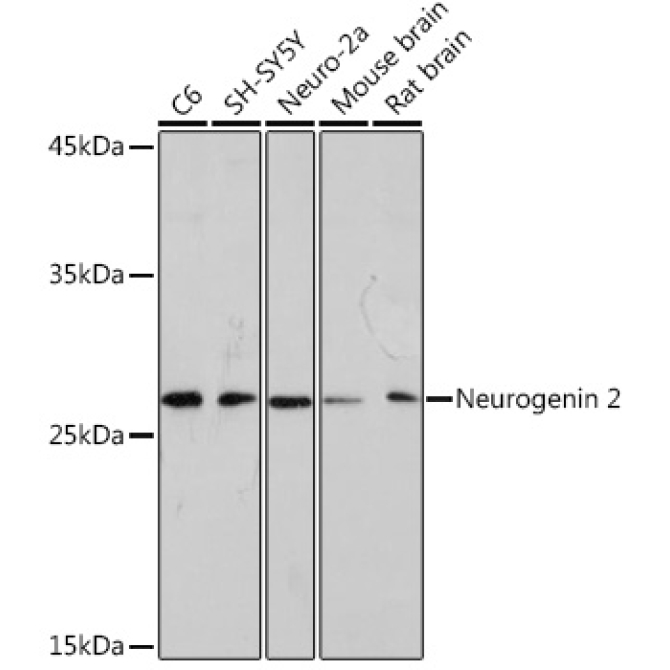 Neurogenin 2 Rabbit Monoclonal Antibody