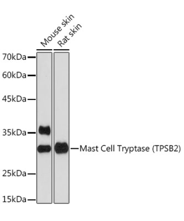 Mast Cell Tryptase (TPSB2) Rabbit Monoclonal Antibody