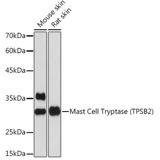 Mast Cell Tryptase (TPSB2) Rabbit Monoclonal Antibody