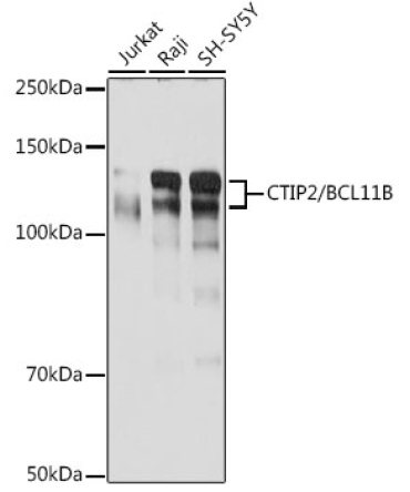 CTIP2/BCL11B Rabbit Monoclonal Antibody
