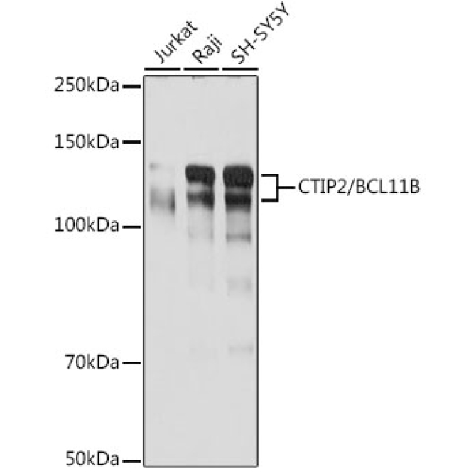 CTIP2/BCL11B Rabbit Monoclonal Antibody