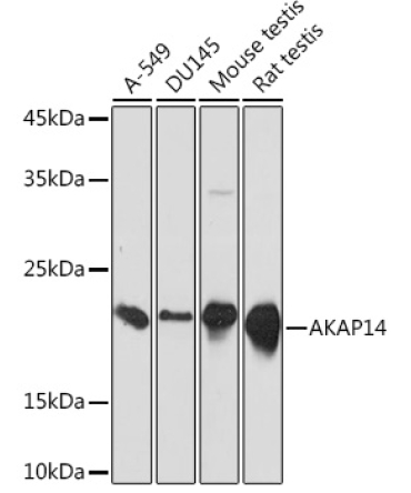 AKAP14 Rabbit Monoclonal Antibody