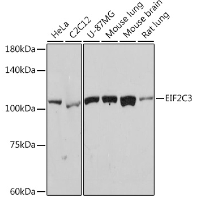 eIF2C3 Rabbit Monoclonal Antibody