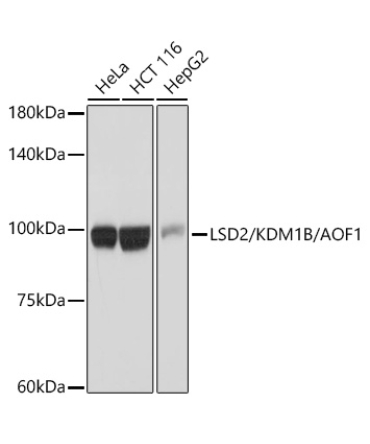 LSD2/KDM1B/AOF1 Rabbit Monoclonal Antibody