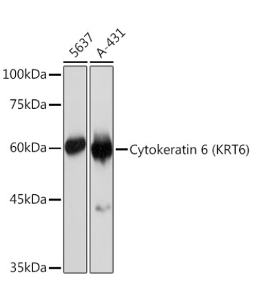 Cytokeratin 6 (KRT6) Rabbit Monoclonal Antibody