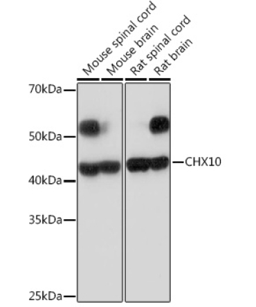 CHX10 Rabbit Monoclonal Antibody