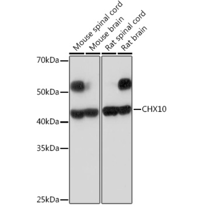 CHX10 Rabbit Monoclonal Antibody