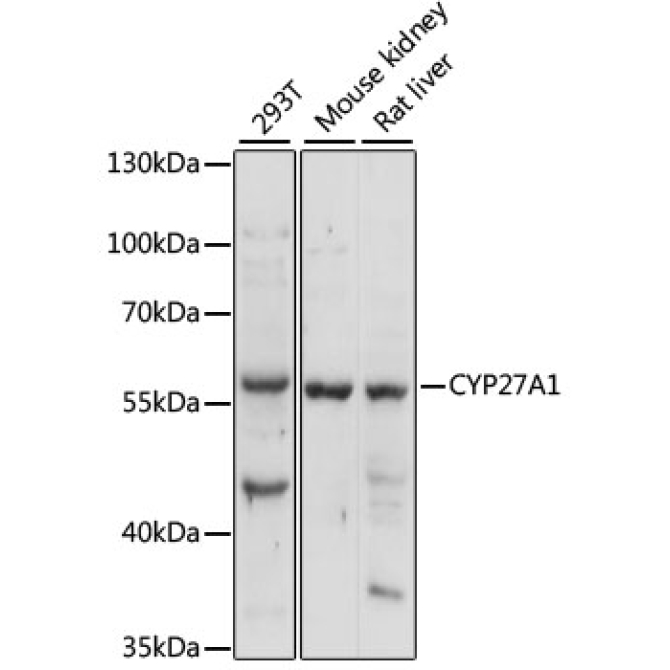 CYP27A1 Rabbit Polyclonal Antibody