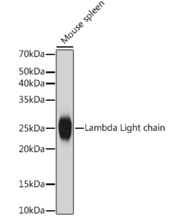 Lambda Light chain Rabbit Monoclonal Antibody