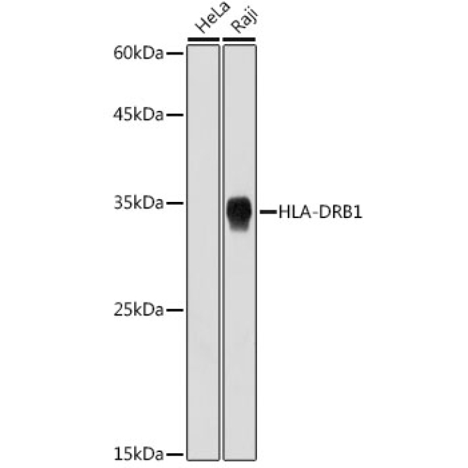 HLA-DRB1 Rabbit Monoclonal Antibody