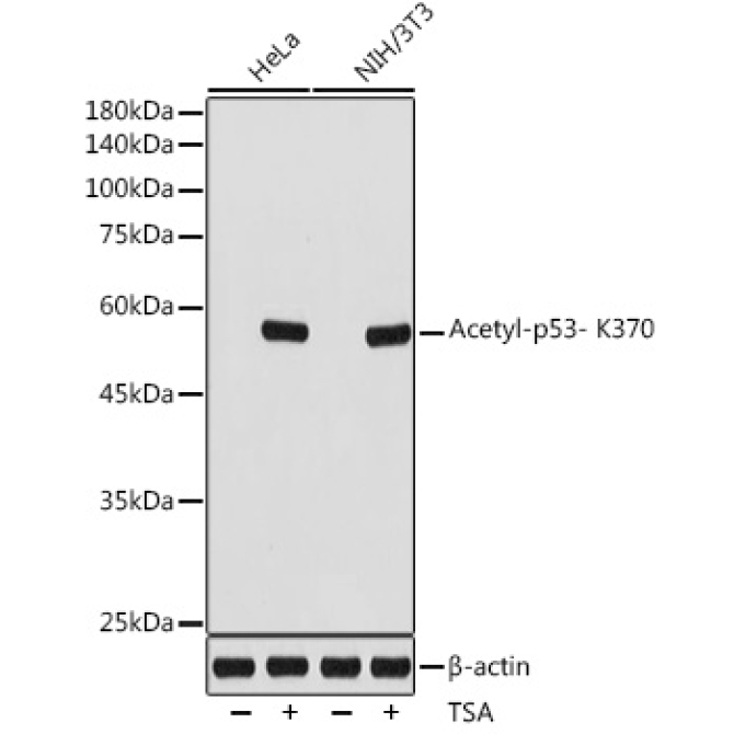 Acetyl-p53- K370 Rabbit Monoclonal Antibody