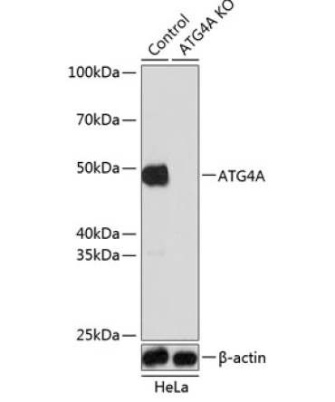 ATG4A Rabbit Polyclonal Antibody [KO Validated]