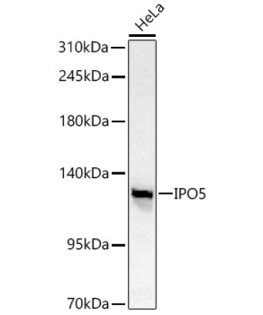 IPO5 Rabbit Polyclonal Antibody