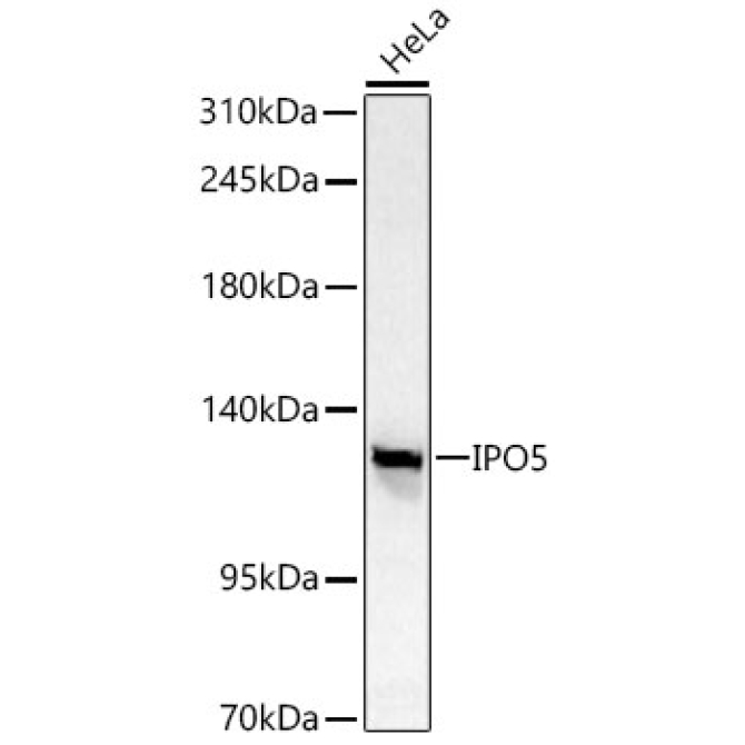 IPO5 Rabbit Polyclonal Antibody