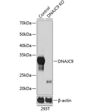 DNAJC9 Rabbit Polyclonal Antibody [KO Validated]