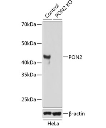 PON2 Rabbit Polyclonal Antibody [KO Validated]
