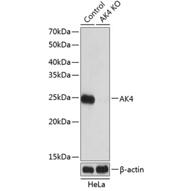 AK4 Rabbit Polyclonal Antibody [KO Validated]