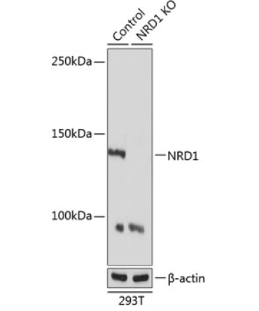 NRD1 Rabbit Polyclonal Antibody [KO Validated]
