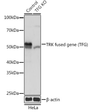 TRK fused gene (TFG) Rabbit Polyclonal Antibody [KO Validated]