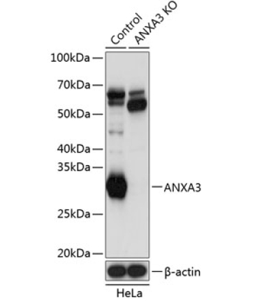 ANXA3 Rabbit Polyclonal Antibody [KO Validated]
