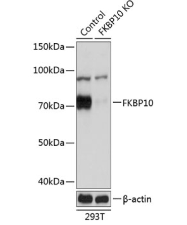 FKBP10 Rabbit Polyclonal Antibody [KO Validated]