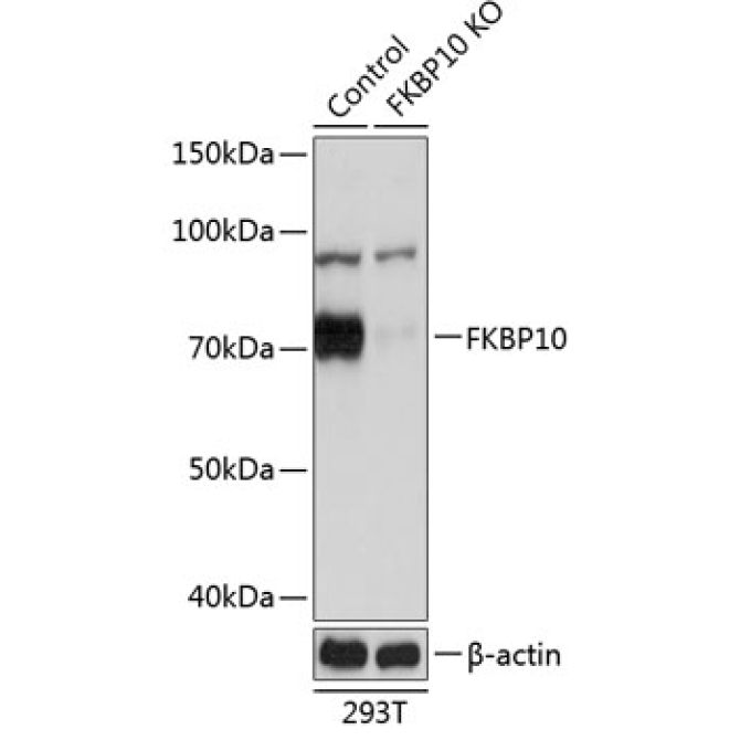FKBP10 Rabbit Polyclonal Antibody [KO Validated]