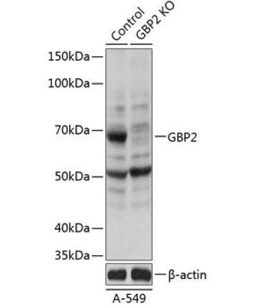 GBP2 Rabbit Polyclonal Antibody [KO Validated]