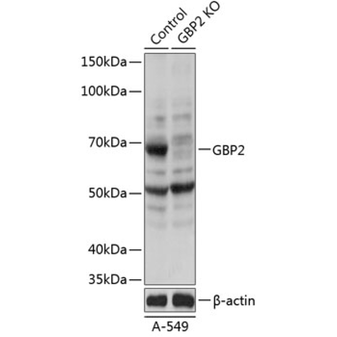 GBP2 Rabbit Polyclonal Antibody [KO Validated]