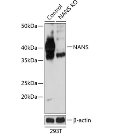 NANS Rabbit Polyclonal Antibody [KO Validated]