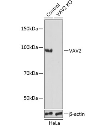 VAV2 Rabbit Polyclonal Antibody [KO Validated]