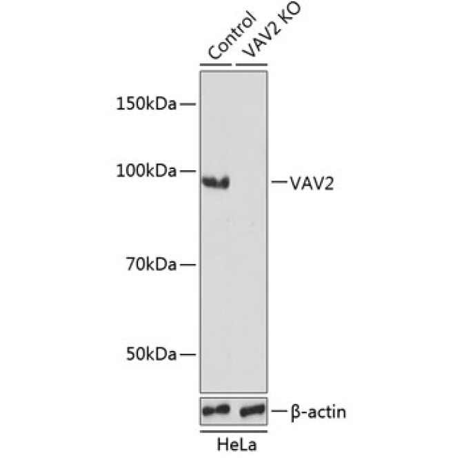 VAV2 Rabbit Polyclonal Antibody [KO Validated]