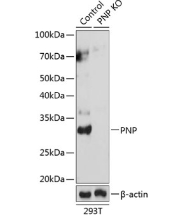 PNP Rabbit Polyclonal Antibody [KO Validated]
