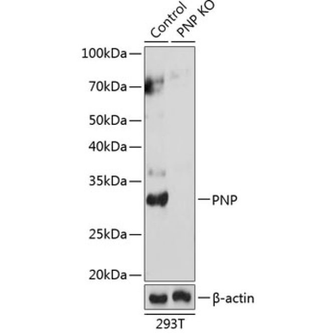 PNP Rabbit Polyclonal Antibody [KO Validated]