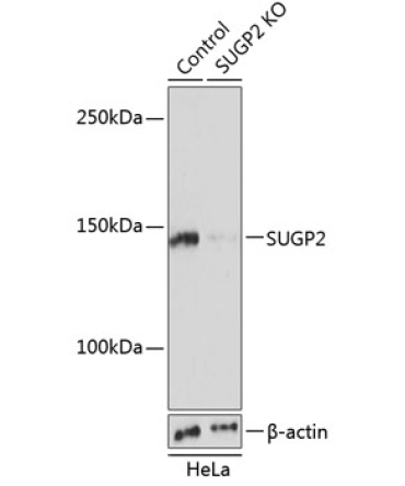 SUGP2 Rabbit Polyclonal Antibody [KO Validated]
