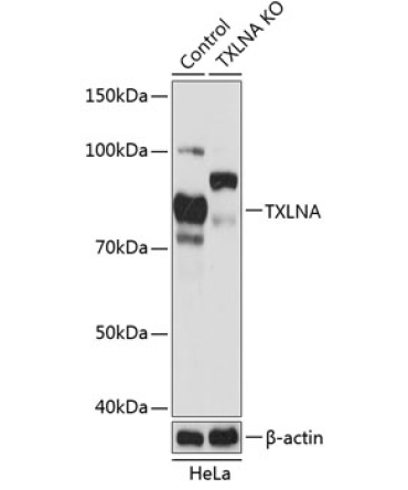 TXLNA Rabbit Polyclonal Antibody [KO Validated]
