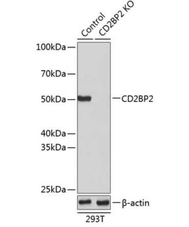 CD2BP2 Rabbit Polyclonal Antibody [KO Validated]