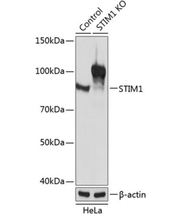 STIM1 Rabbit Polyclonal Antibody [KO Validated]