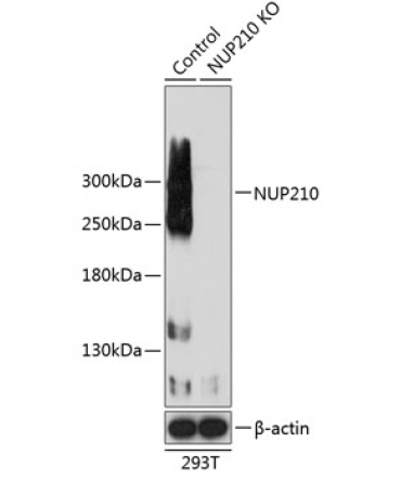 NUP210 Rabbit Polyclonal Antibody [KO Validated]