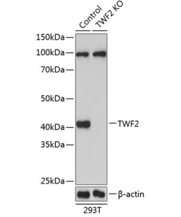 TWF2 Rabbit Polyclonal Antibody [KO Validated]