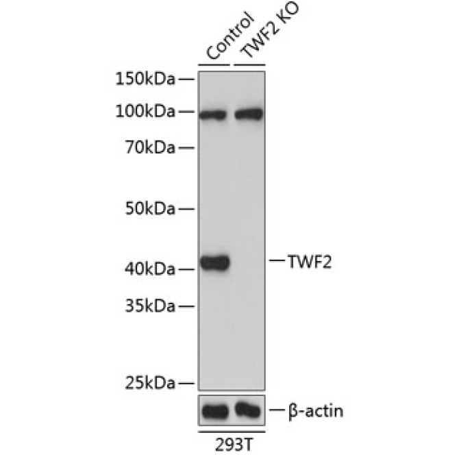 TWF2 Rabbit Polyclonal Antibody [KO Validated]