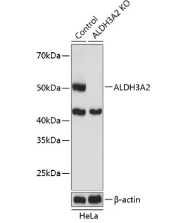 ALDH3A2 Rabbit Polyclonal Antibody [KO Validated]