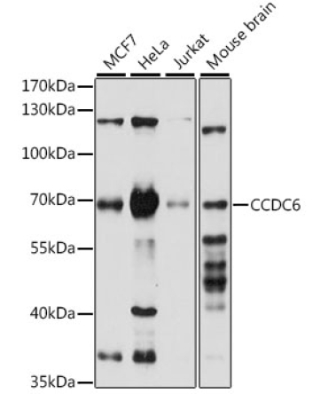 CCDC6 Rabbit Polyclonal Antibody [KO Validated]