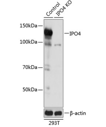 IPO4 Rabbit Polyclonal Antibody [KO Validated]