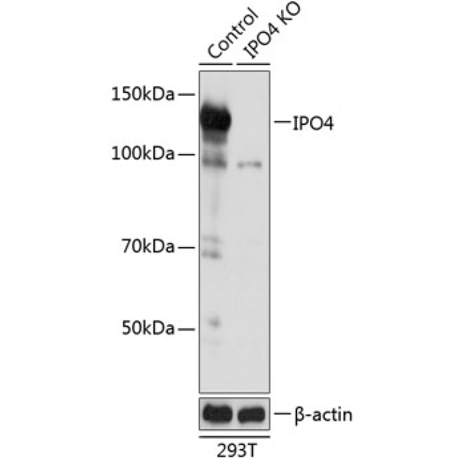 IPO4 Rabbit Polyclonal Antibody [KO Validated]
