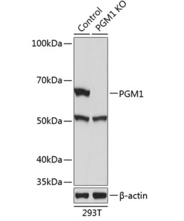 PGM1 Rabbit Polyclonal Antibody [KO Validated]
